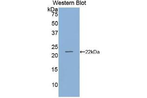 Western blot analysis of the recombinant protein. (RBP4 抗体  (AA 19-201))
