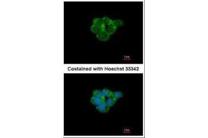 ICC/IF Image Immunofluorescence analysis of methanol-fixed A431, using Nicotinic Acetylcholine Receptor alpha 3, antibody at 1:500 dilution. (CHRNA3 抗体  (Center))