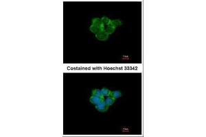 ICC/IF Image Immunofluorescence analysis of methanol-fixed A431, using Nicotinic Acetylcholine Receptor alpha 3, antibody at 1:500 dilution. (CHRNA3 抗体  (Center))
