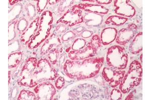 Human Kidney: Formalin-Fixed, Paraffin-Embedded (FFPE) (GPR81 抗体  (Cytoplasmic Domain))