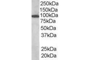 ABIN185278 (1 µg/mL) staining of human bone marrow lysate (35 µg protein in RIPA buffer). (VAV3 抗体  (Internal Region))