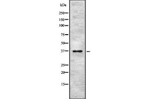 Western blot analysis of PINX1 using NIH-3T3 whole cell lysates (PINX1 抗体  (Internal Region))