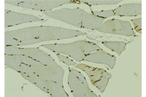 ABIN6278734 at 1/100 staining Mouse muscle tissue by IHC-P. (AKAP6 抗体  (C-Term))