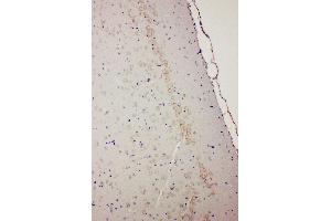 Anti-Dopamine Receptor D1 antibody, IHC(P) IHC(P): Rat Brain Tissue (Dopamine Receptor d1 抗体  (Middle Region))