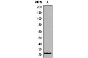 Western blot analysis of RhoXF1 expression in Jurkat (A) whole cell lysates. (RHOXF1 抗体  (C-Term))