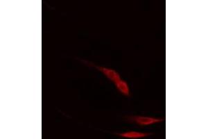 ABIN6267403 staining HepG2 cells by IF/ICC. (Phospholipase C gamma 2 抗体  (pTyr753))