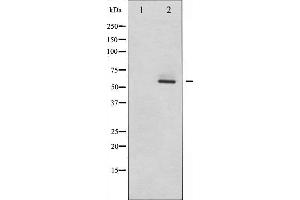 Western blot analysis of Estrogen Receptor-beta expression in EGF treated HeLa whole cell lysates,The lane on the left is treated with the antigen-specific peptide.