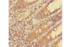 Immunohistochemistry (IHC) image for anti-General Transcription Factor IIF, Polypeptide 1, 74kDa (GTF2F1) (AA 1-249) antibody (ABIN7153793)