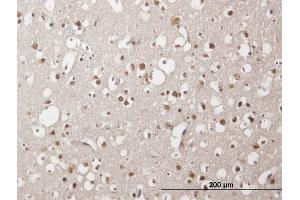 Immunoperoxidase of purified MaxPab antibody to ZNF483 on formalin-fixed paraffin-embedded human cerebral cortex. (ZNF483 抗体  (AA 1-244))
