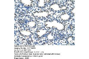 Human Lung (ARIH2 抗体  (N-Term))