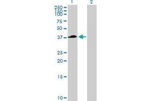 Western Blot analysis of TFB2M expression in transfected 293T cell line by TFB2M MaxPab polyclonal antibody. (TFB2M 抗体  (AA 1-396))
