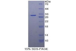 SDS-PAGE analysis of Human PAI2 Protein. (SERPINB2 蛋白)