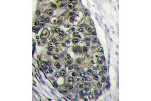Immunohistochemistry (Paraffin-embedded Sections) (IHC (p)) image for anti-Low Density Lipoprotein Receptor-Related Protein 6 (LRP6) (AA 1531-1560), (C-Term) antibody (ABIN390100)