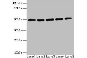 Western blot All lanes: KCNJ4 antibody at 2. (KCNJ4 抗体  (AA 316-445))