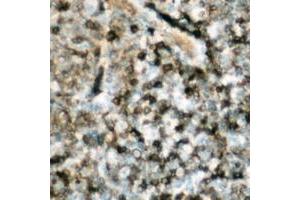 Immunohistochemical analysis of p47 phox (pS359) staining in human lymph node formalin fixed paraffin embedded tissue section. (NCF1 抗体  (C-Term, pSer359))