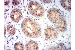 Immunohistochemical analysis of paraffin-embedded stomach tissues using MUC5AC mouse mAb with DAB staining. (MUC5AC 抗体  (AA 28-327))