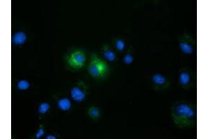 Anti-FSHB mouse monoclonal antibody (ABIN2453054) immunofluorescent staining of COS7 cells transiently transfected by pCMV6-ENTRY FSHB (RC214616). (FSHB 抗体)