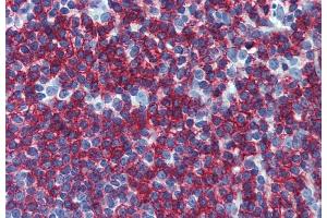 Immunohistochemistry staining of human small intestine (paraffin-embedded sections) with anti-CD45RB (MEM-55). (CD45RB 抗体)