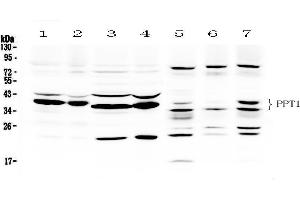 Western blot analysis of PPT1 using anti- PPT1 antibody . (PPT1 抗体  (C-Term))