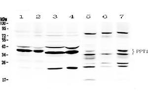 Western blot analysis of PPT1 using anti- PPT1 antibody . (PPT1 抗体  (C-Term))