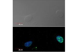 Immunocytochemistry detection of Ki-67 in U2OS cell line (human osteosarcoma) using monoclonal antibody Ki-67 (green). (Ki-67 抗体)