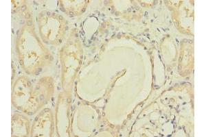 Immunohistochemistry of paraffin-embedded human kidney tissue using ABIN7150185 at dilution of 1:100 (MCM9 抗体  (AA 1-391))