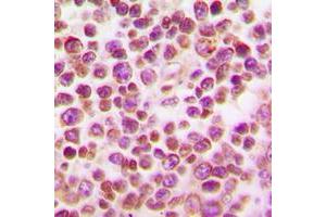 Immunohistochemical analysis of IRF4 staining in human tonsil formalin fixed paraffin embedded tissue section. (IRF4 抗体  (Center))
