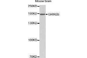 Western blot analysis of extracts of mouse brain, using GRIN2B antibody (ABIN2974534). (GRIN2B 抗体)