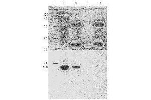 Western Blotting (WB) image for anti-Human Papilloma Virus 11 E7 (HPV-11 E7) (AA 36-70) antibody (ABIN781777) (人 Papilloma Virus 11 E7 (HPV-11 E7) (AA 36-70) 抗体)