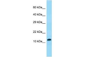 WB Suggested Anti-VKORC1 Antibody Titration: 1. (VKORC1 抗体  (N-Term))