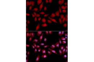 Immunofluorescence analysis of U2OS cell using PSMA2 antibody. (PSMA2 抗体  (AA 1-234))
