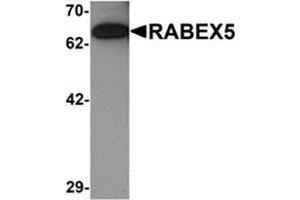 Western blot analysis of RABEX5 in rat brain tissue lysate with RABEX5 antibody at 1 μg/ml. (RABGEF1 抗体  (Center))
