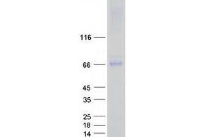 Western Blotting (WB) image for Acyloxyacyl Hydrolase (Neutrophil) (AOAH) protein (Myc-DYKDDDDK Tag) (ABIN2714378)