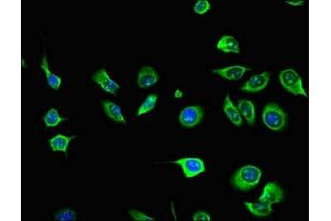 Immunofluorescent analysis of A549 cells using ABIN7156703 at dilution of 1:100 and Alexa Fluor 488-congugated AffiniPure Goat Anti-Rabbit IgG(H+L) (AIM2 抗体  (AA 81-326))