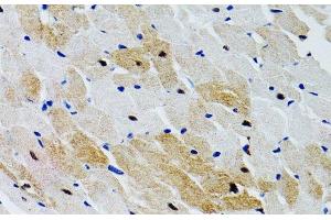 Immunohistochemistry of paraffin-embedded Rat heart using PTPN11 Polyclonal Antibody at dilution of 1:100 (40x lens). (PTPN11 抗体)