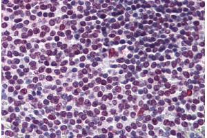 Human Spleen: Formalin-Fixed, Paraffin-Embedded (FFPE) (RCC1 抗体  (AA 312-421))