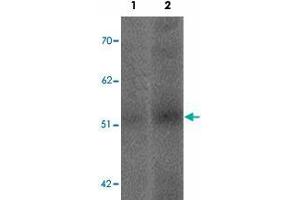 Western blot analysis of SLC39A14 in human spleen tissue lysate with SLC39A14 polyclonal antibody  at (1) 1 and (2) 2 ug/mL. (SLC39A14 抗体  (Internal Region))