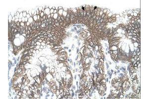 Image no. 1 for anti-threonyl-tRNA Synthetase (TARS) (AA 51-100) antibody (ABIN341310) (TARS 抗体  (AA 51-100))