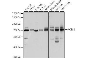 Western blot analysis of extracts of various cell lines, using ACSS2 antibody (ABIN2560918) at 1:1000 dilution. (ACSS2 抗体)