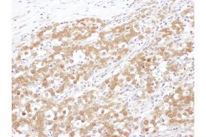 anti-NUDC (AA 281-331) antibody