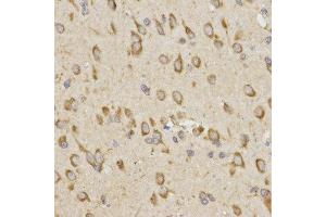 Immunohistochemistry of paraffin-embedded rat brain tissue using GRM8 antibody at dilution of 1:200 (x400 lens) (GRM8 抗体)
