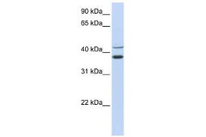 MKRN2 antibody used at 1 ug/ml to detect target protein. (MKRN2 抗体  (N-Term))