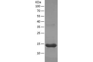 Western Blotting (WB) image for CD34 (CD34) (AA 124-225) protein (His tag) (ABIN7122201)
