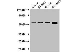Western Blot Positive WB detected in: Mouse liver tissue, Mouse kidney tissue, Mouse brain tissue, Mouse stomach tissue All lanes: NOTUM antibody at 2. (NOTUM 抗体  (AA 100-235))