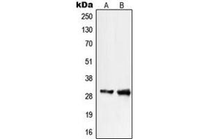 Western blot analysis of PIGX expression in COLO205 (A), WI38 (B) whole cell lysates. (PIGX 抗体  (C-Term))