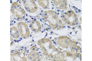 Immunohistochemistry of paraffin-embedded Human stomach using ST8SIA2 Polyclonal Antibody at dilution of 1:100 (40x lens). (ST8SIA2 抗体)