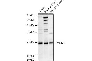 Western blot analysis of extracts of various cell lines, using MGMT antibody (ABIN3021096, ABIN3021097, ABIN3021098 and ABIN6213949) at 1:1000 dilution. (MGMT 抗体  (AA 1-207))