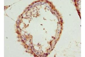 Immunohistochemistry of paraffin-embedded human testis tissue using ABIN7153465 at dilution of 1:100 (LGALS8 抗体  (AA 20-317))