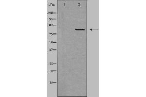 Western blot analysis of extracts from HepG2 cells using CPT1B antibody. (CPT1B 抗体  (Internal Region))