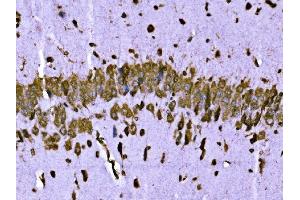 IHC analysis of BRSK1 using anti-BRSK1 antibody (ABIN7600990). (BRSK1 抗体  (AA 269-321))